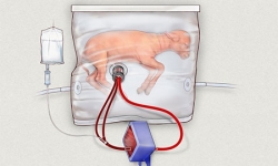 Ερευνητές δημιούργησαν τεχνητή μήτρα για να σώζουν μωρά που γεννιούνται πρόωρα! [video]